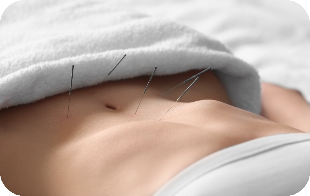Fertility Acupuncture sammilana servicess