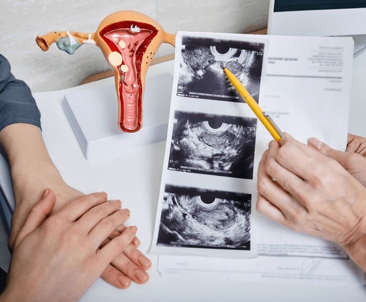 Female Fertility