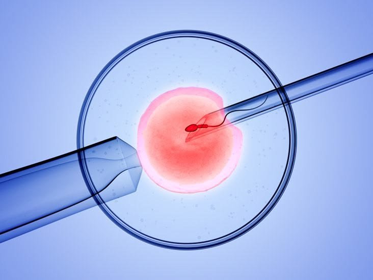 IVF and Embryo Transfer