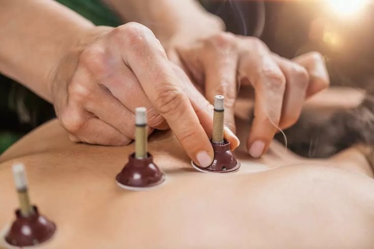 Moxibustion 1